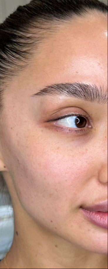 Lauren - after